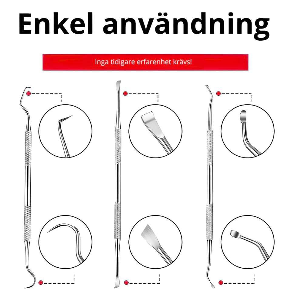 Tandstensskrapa 3 Set – Effektiv Tandvård Hemma för Hund & Katt